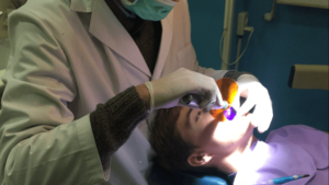 blanqueamiento Dental Dental denche dentistas en madrid