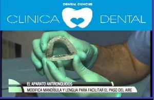 Férula anti ronquidos en Madrid, Dental Denche